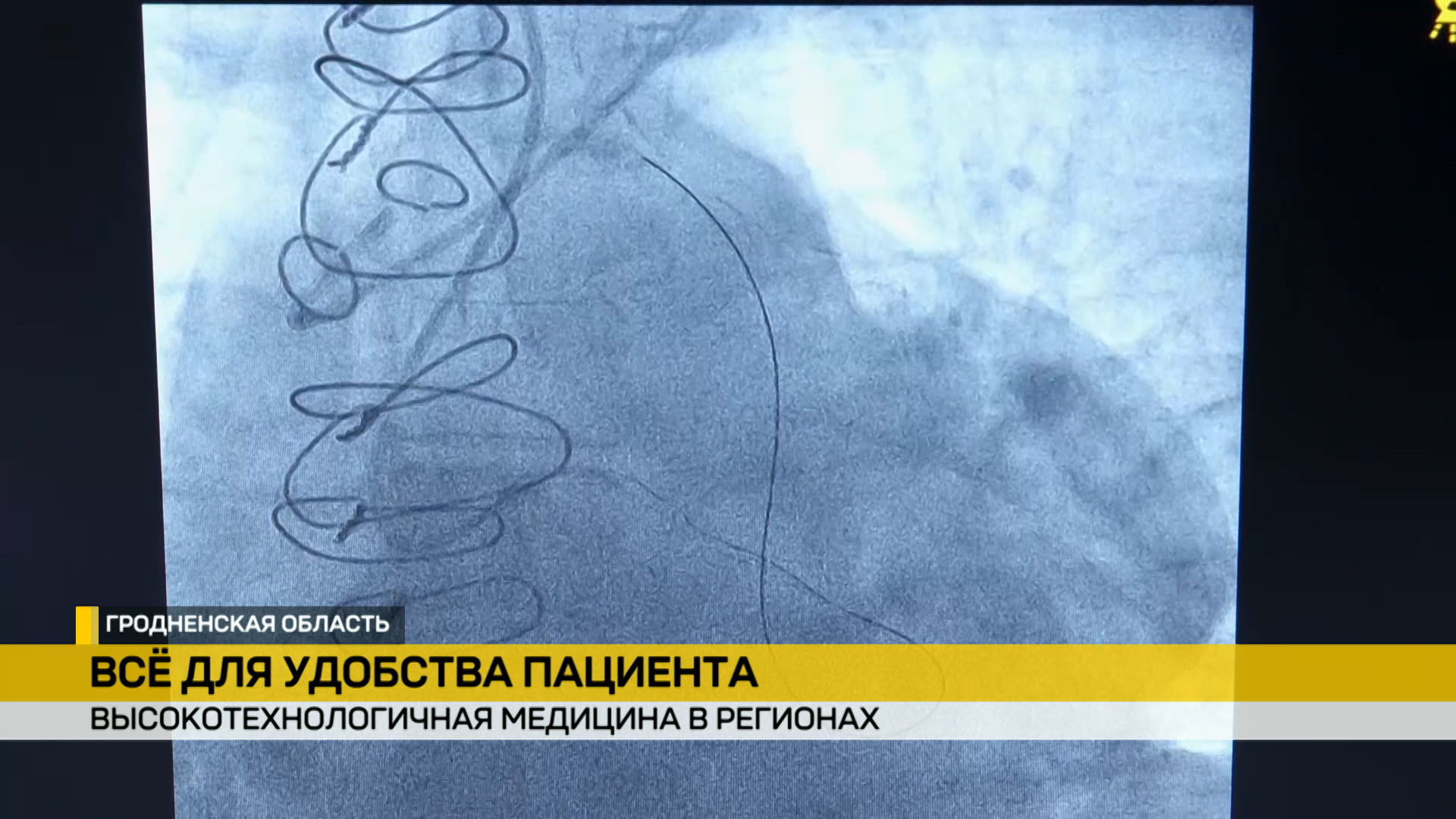 рентген сосуды